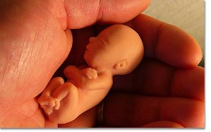 LEYES SOBRE EL ABORTO leyes sobre el aborto: